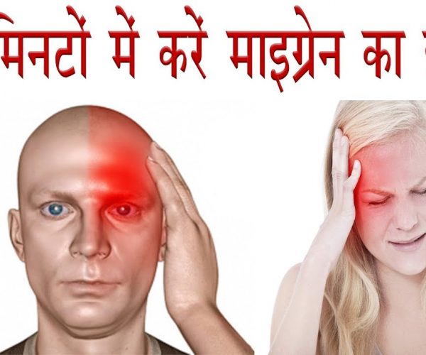 माइग्रेन (आधेसर दर्द के घरेलू उपाय)