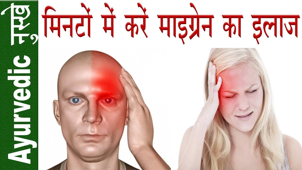 माइग्रेन (आधेसर दर्द के घरेलू उपाय)